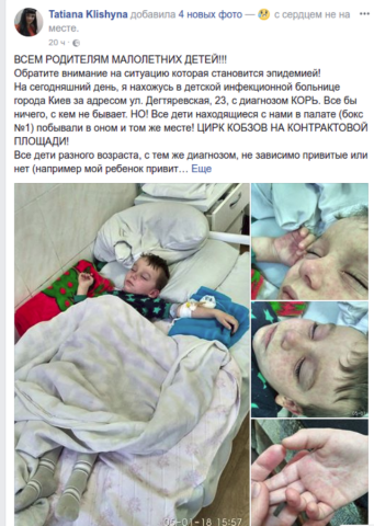 Киевляне сообщают о случаях заболевания детей корью: подробности
