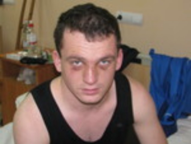 Беспредел в ночном клубе Львова: охранники, ничего не объясняя, зверски избили бизнесмена