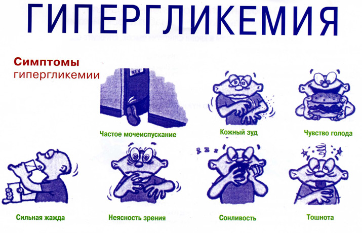 Гипергликемия состояние. Гипергликемический синдром. Гипергликемия. Гипергликемия при. Симптомы гипогликемии и гипергликемии.