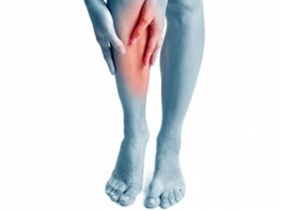 10 способов справиться с варикозом