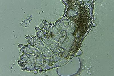 Лица людей служат жильем для миллионов клещей 